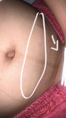 Tanong lang po sa mga cs moms