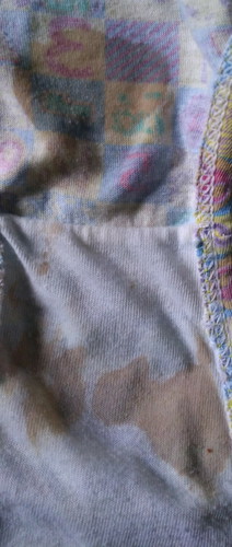Vaginal Discharge