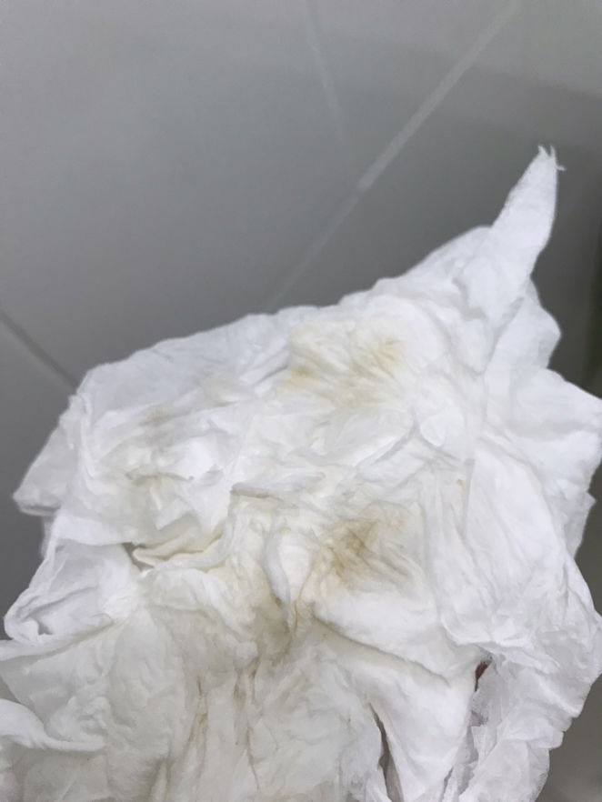 ใกล้คลอดหรือป่าวคะ