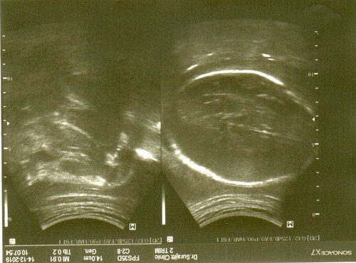 แนะนำชื่อจริงลูกสาว+ชื่อเล่นหน่อยคะ.