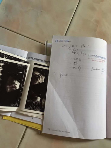 34 w 3 d masih sungsang