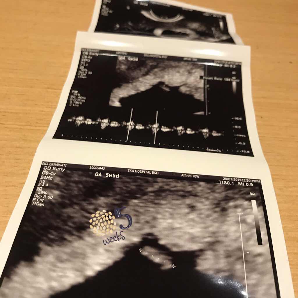 Eka Ernawati profile icon