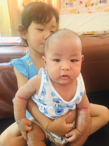 มีเหงื่อที่แขน