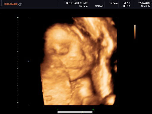 รวยรินทร์ อุไร profile icon