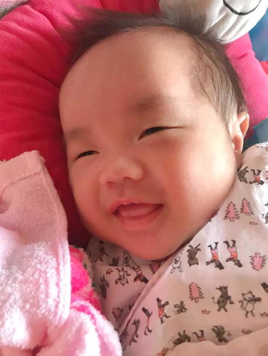 แชร์ประสบการ ผ่าคลอด