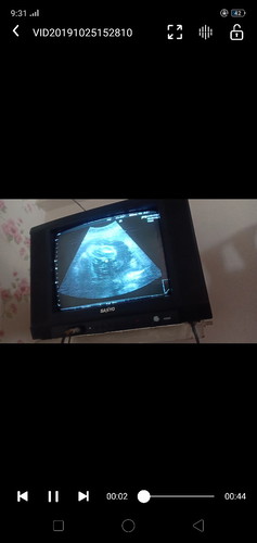 baby boy?