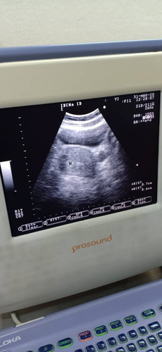 5สัปดาห์ กังวลมาก