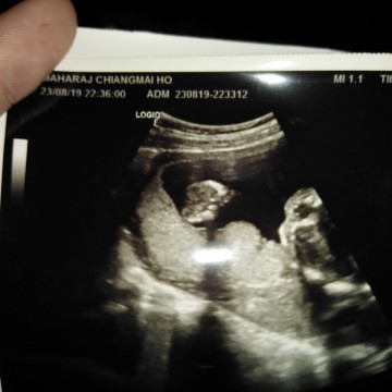 ดูเพศออกมั้ยคะ