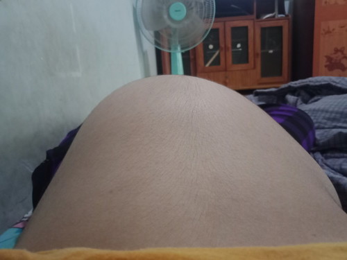 โก่งตัวว