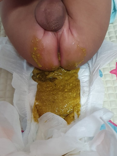 อุจจาระ ลูกน้อย