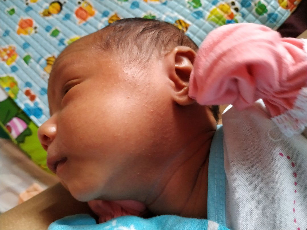 bintik merah pada kulit