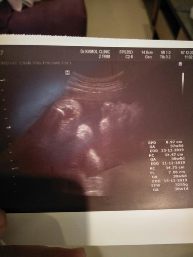 38w3d