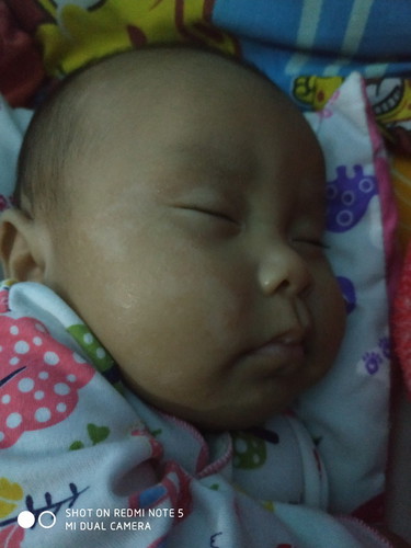 kulit bayi