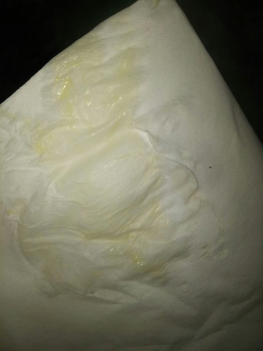 maaf klo jijik'an jgn di liat foto nya bun ?