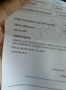 ultrasound