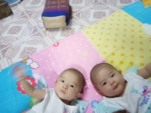 คลอดน้องแฝดค่ะ