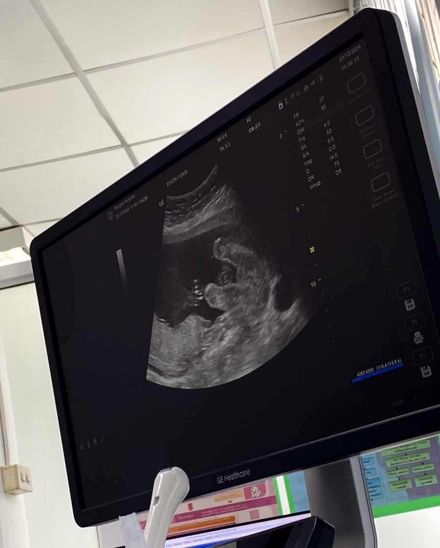 ซาวด์ดูเพศตอน20วีค