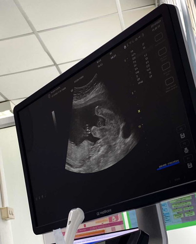 ซาวด์ดูเพศตอน20วีค