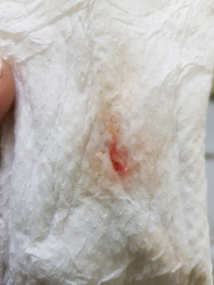 ตั้งครรภ์ 6 สัปดาห์ มีมูกเลือดค่ะ