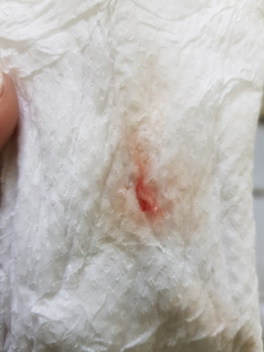 ตั้งครรภ์ 6 สัปดาห์ มีมูกเลือดค่ะ