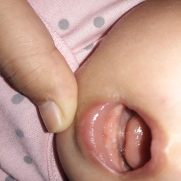 gusi bayi