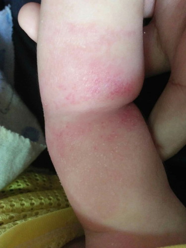 อาการแบบนี้ลูกคัยเปนบ้าง