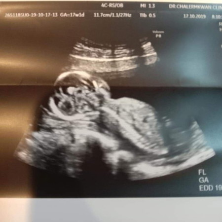 แม่คนไหนเข้าเดือนที่4กันบ้างค่ะ ผู้หญิงหรือผู้ชาย กันค่ะ