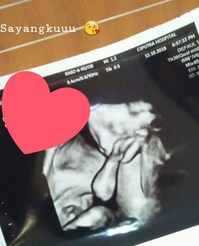 IUFD Setahun yang lalu