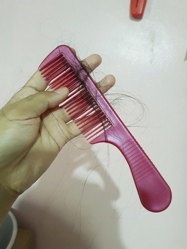 hair fall