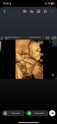 Rianni nuriqqrom profile icon