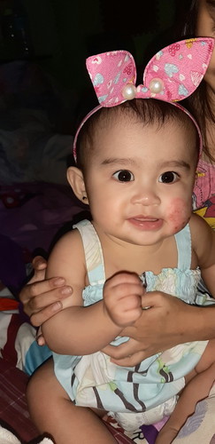 Derma for baby