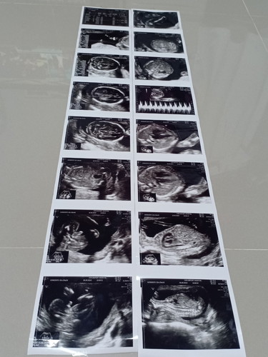 19w2d 293g สุขภาพแข็งแรง