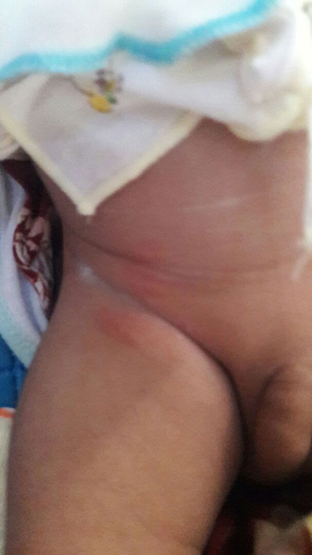 kulit paha dan perut