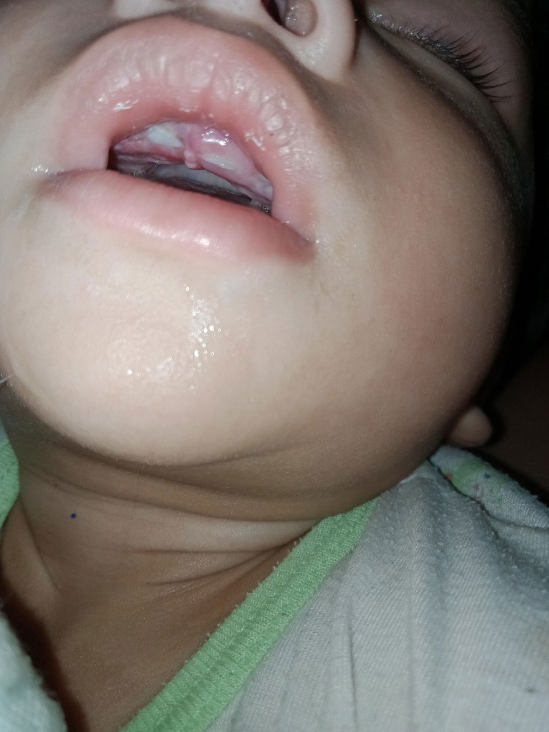 เหงือกของลูกที่ฟันกำลังงอก