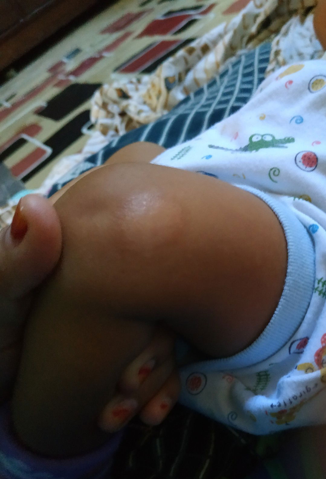 kulit kering bayi