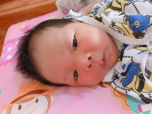 โกนผมไฟ