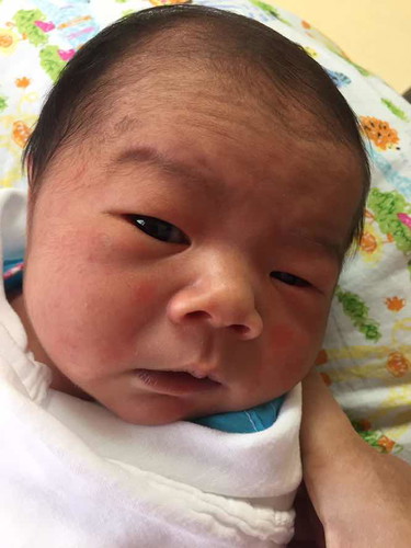 น้องเพิ่งเกิดได้ 3 วัน มีผื่นแดงที่หน้า กับที่แขน เป็นอะไรมั้ยคะ หรือว่าแพ้อะไร