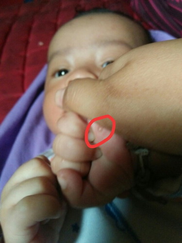 kulit bayi