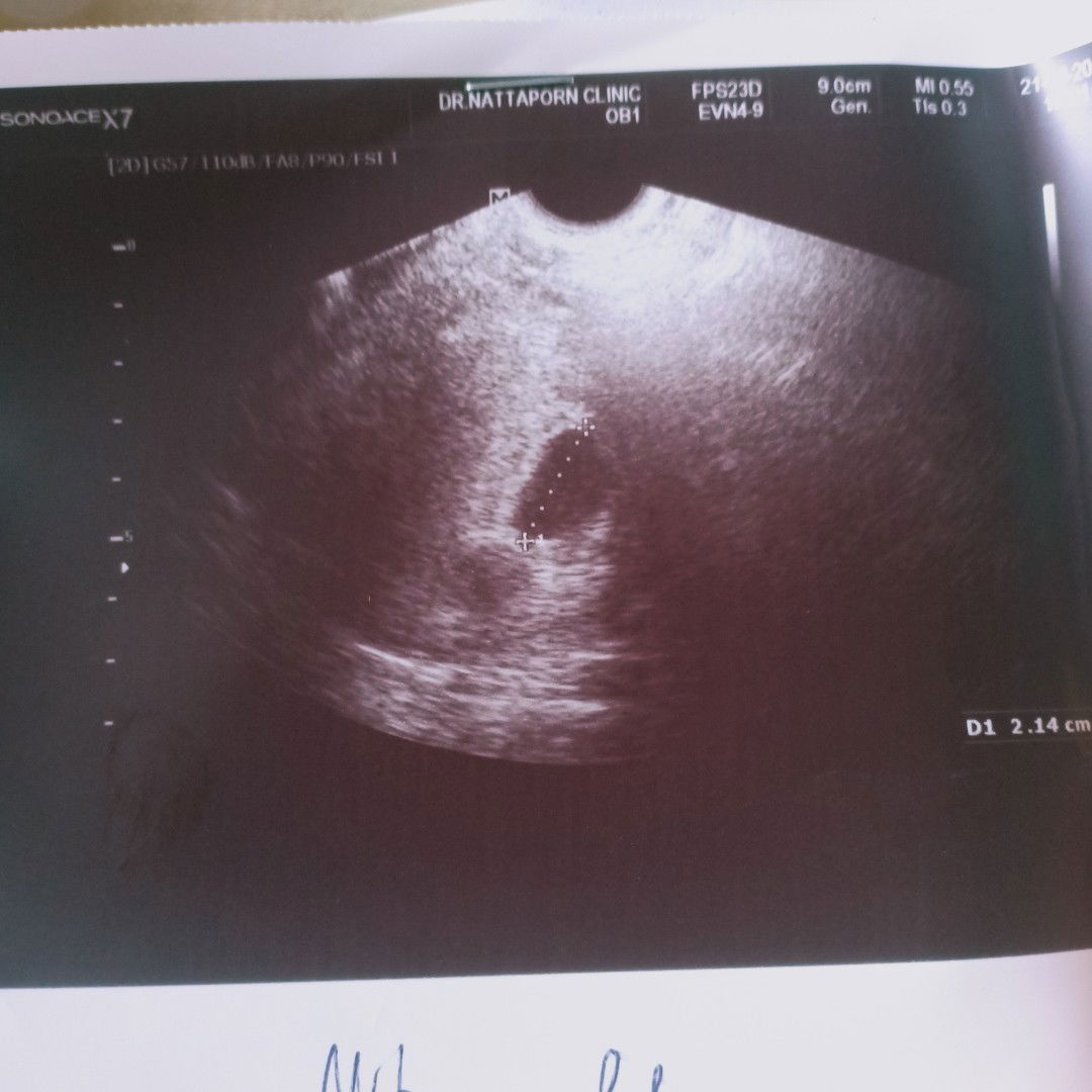 อยากให้มีปาฏิหาริย์