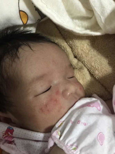 มีวิธีรักษายังไงบ้างค่ะ