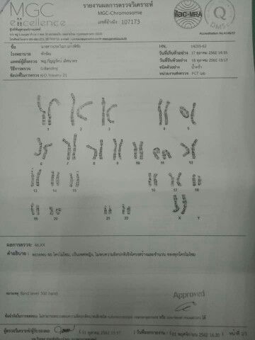 ผลเจาะน้ำคร่ำ