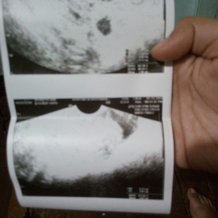 preggy