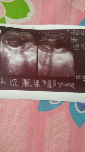 สอบถามเรื่องเพศลูก