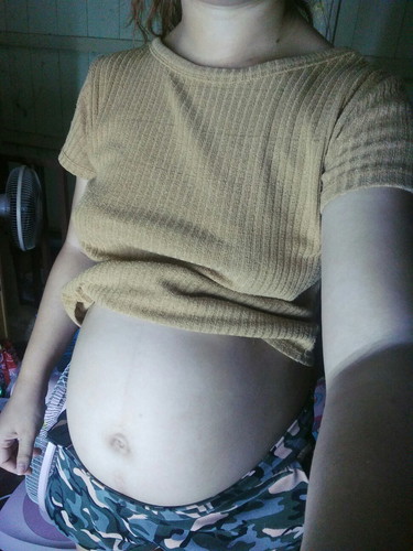 อุลตร้าซาวด์ค่ะ