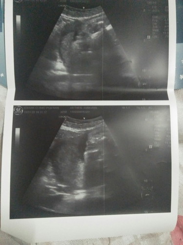 ตั้งครรภ์