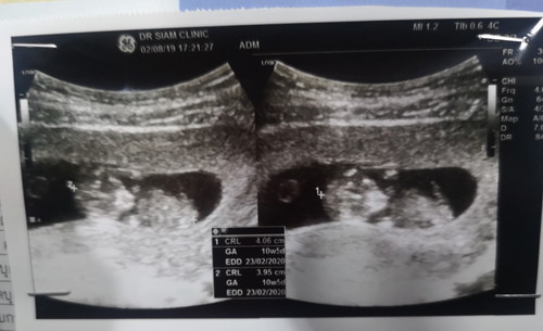 ภาพแรกของการฝากครรภ์ 2/8/19