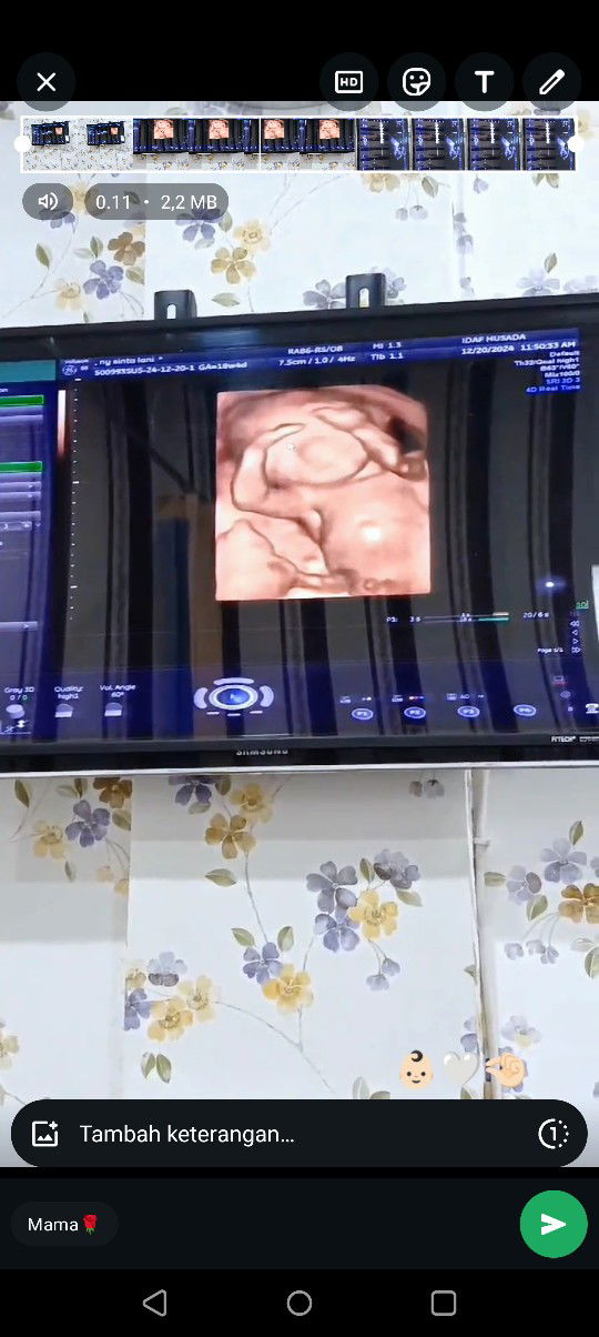 usg 4d jenis kelamin