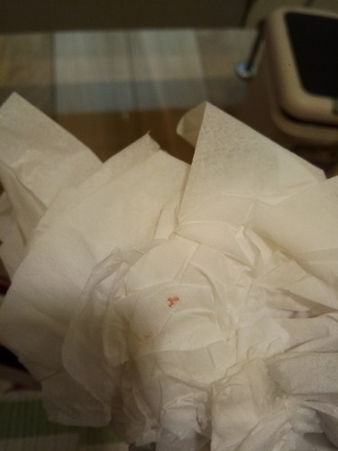 มีเลือดออกเป็นจุด