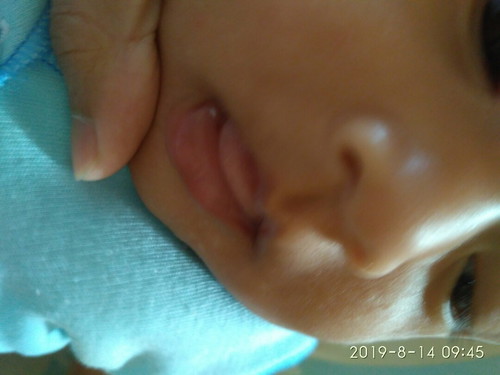 Bibir