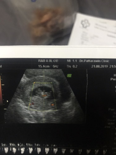 อายุครรภ์ 9 สัปดาห์จ้า